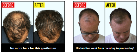 TruVarin Customer Reviews