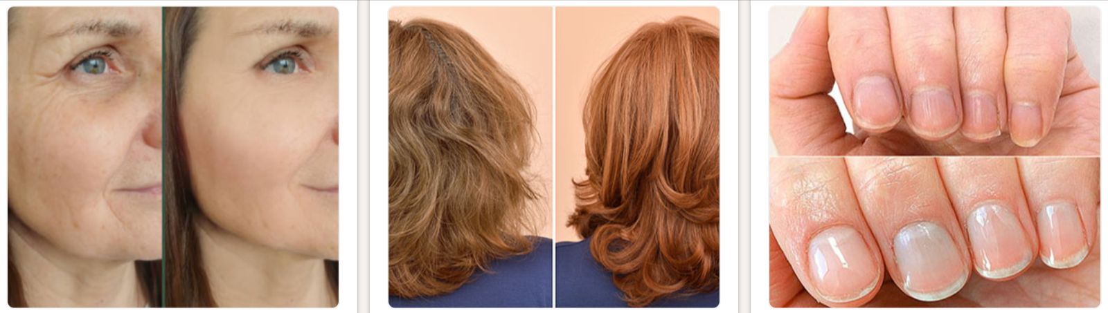 Everbella Collagen NutraBoost Gummies Customers