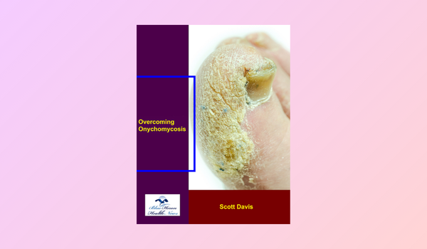 Overcoming Onychomycosis Reviews